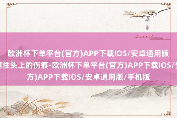 欧洲杯下单平台(官方)APP下载IOS/安卓通用版/手机版＂一是思遮住头上的伤痕-欧洲杯下单平台(官方)APP下载IOS/安卓通用版/手机版